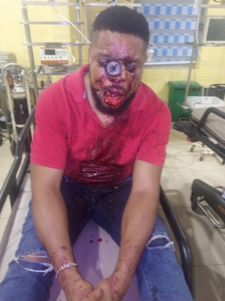 Trigger-happy Policeman Kills Abuja Resident